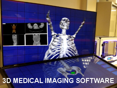 3D Medical Image Processing